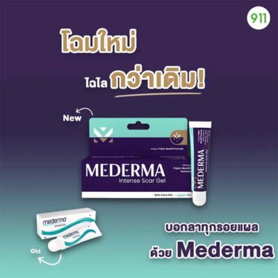 Mederma Intense Scar Gel แผลเป็น แผลเป็นคียลอยด์