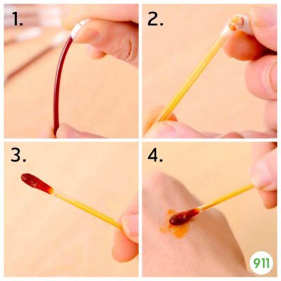 วิธีใช้ ก้านสำลี โพวิโดน-ไอโอดีน