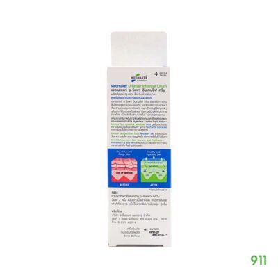 ยู-รีแพร์ อินเทนซีฟ ครีม U-Repair Intensive Cream ผิวแห้งตกสะเก็ด