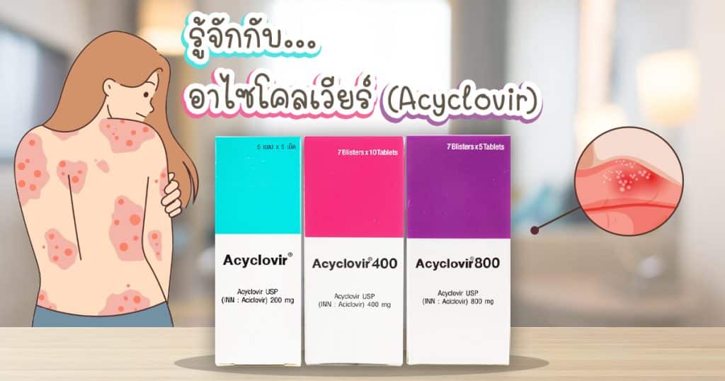 เป็นเริม สะเก็ดเงิน แก้ยังไง