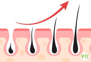 ผมขึ้นใหม่ ดกดำ