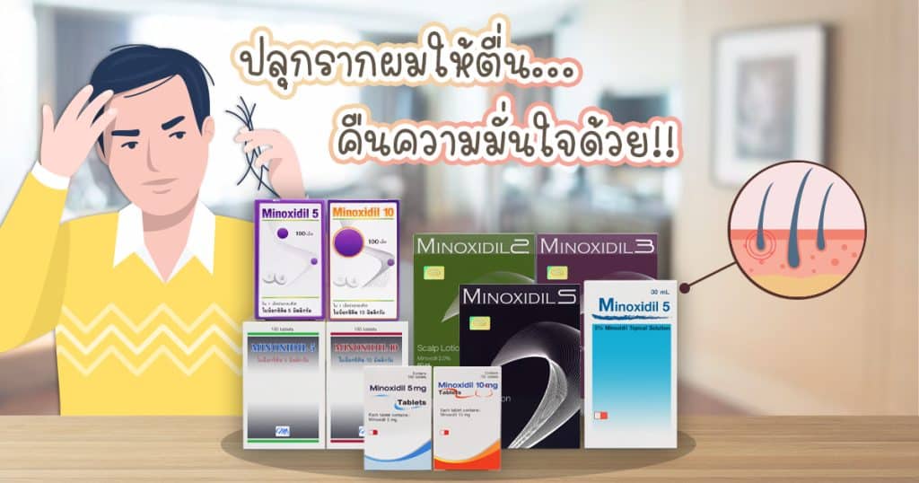 ยาปลูกผม Minoxidil